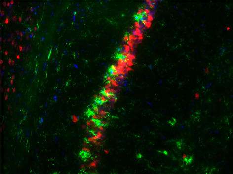 This image depicts a section of a brain a week after an initial seizure. In such cases, microglial cells, stained green, sometimes engulf and attack neurons, stained red. Two drugs currently being tested in an ISU biomedical sciences lab may silence or control the microglial cells and prevent spontaneous seizures. Photo courtesy of Thimmasettappa Thippeswamy. - See more at: http://www.news.iastate.edu/news/2014/09/30/biomedicalepilepsy#sthash.2ERrvSk6.dpuf