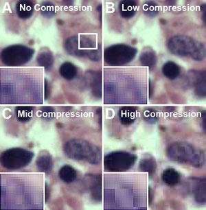 Image A is the original image saved in the TIFF format. Images B, C and D show progressive destruction of A, as a result of image compression when saving in the JPEG format. Image B was saved as JPEG in Photoshop with a low compression at a setting of 10; Image C was saved at a mid-level compression of 6; and Image D at a high compression level of 1.