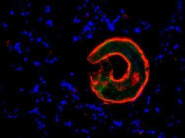 Hookworms infect the lung and cause severe inflammation. Image shows immunofluorescent staining of infected mouse lung tissue for worm antigen (green), worm and macrophage bound lectin (red) and cell nuclei (blue). (Credit: NAIR Lab, UC Riverside)