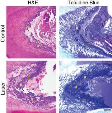 Researchers used high-resolution x-ray imaging and microscopy techniques to assess the formation of reparative (tertiary) dentin 12 weeks after the low-power laser treatment. In the microscopy images shown here, the yellow hashtags (#) sit atop the newly-formed tertiary dentin; there is more tertiary dentin in the laser-treated teeth than in the control. (Source: HMS/Harvard's Wyss Institute, SEAS)