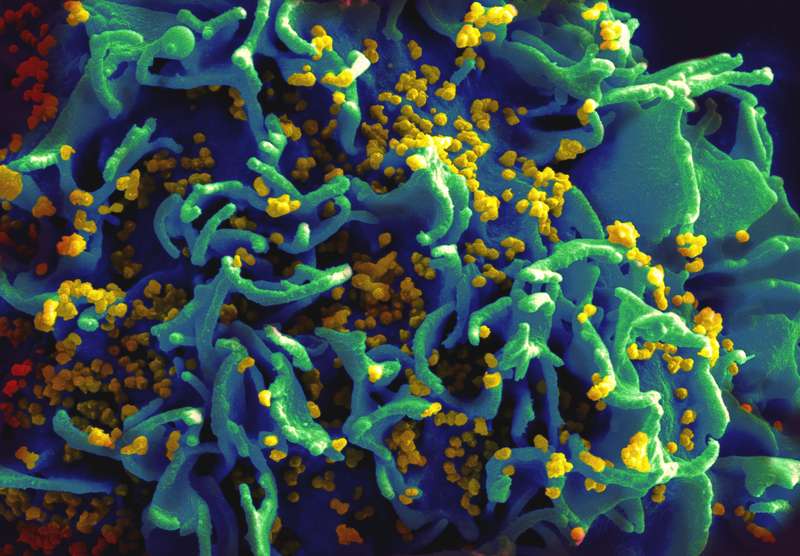 Scanning electron micrograph of HIV particles infecting a human T cell.