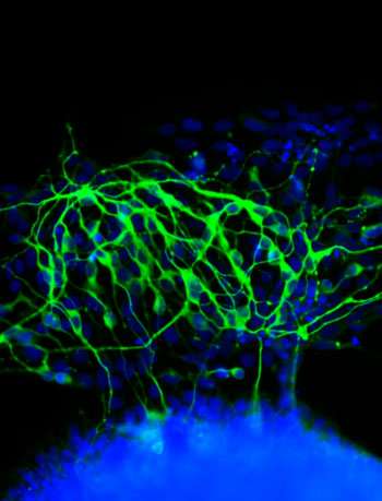 When blank slate stem cells are exposed to a soft rather than hard surface on which to grow, they begin to transform into neurons. (Source: University of Wisconsin/Kiessling Lab)