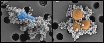 This image demonstrates the effectiveness of the genetically engineered protein-coated magnetic beads binding to pathogens. Here, the magnetic beads (128 nm) are bound to two pathogens (E. coli on the left and S. aureus on the right). (Source: HMS/Harvard’s Wyss Institute)