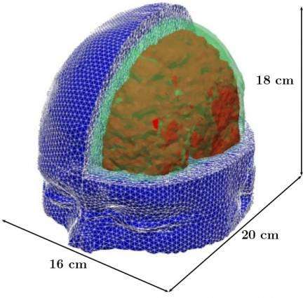 MIT researchers have developed a model of the human head for use in simulations to predict the risk for blast-induced traumatic brain injury. Relevant tissue structures include the skull (green), brain (red), and flesh (blue). (Source: MIT researchers)