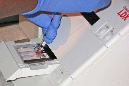 Cholesterol test. (Source: AHA)