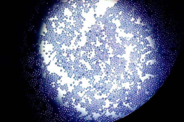 Oval Saccharomyces cerevisiae yeast cells magnified by 400 times. (Source: MIT/A. Doubt, Wikimedia Commons)