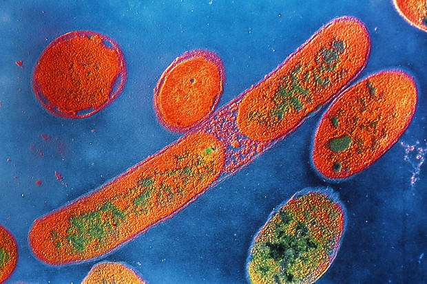 Bacteria such as Pseudomonas aeruginosa appear to trigger an immune response after interfering with mitochondrial function inside (Source: Memorial Sloan Kettering Cancer Center)