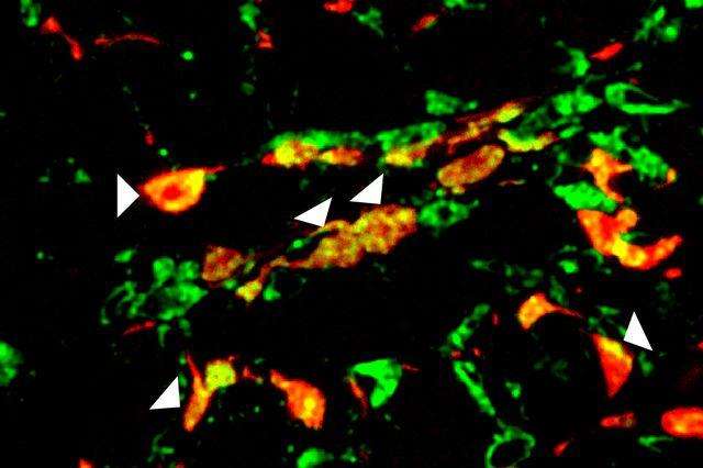 Scar-forming cells (in red) in a region of the injured heart expressing endothelial marker in green and thus appearing yellow (indicated by arrows). (Source: UCLA)