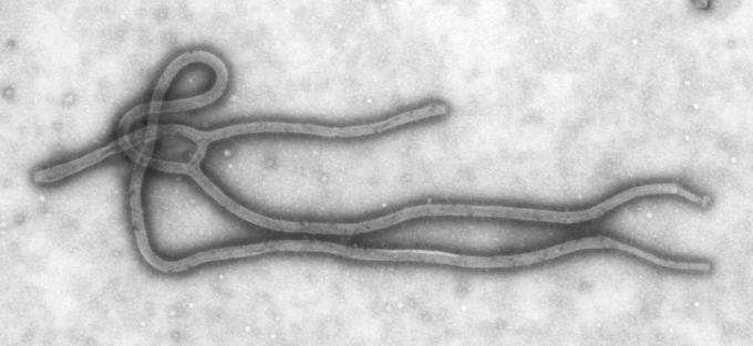 Ebola virus (Source: UNC/CDC)