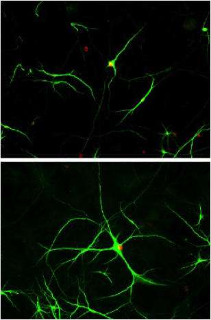 In the top image, cells from a mouse model of amyotrophic lateral sclerosis caused normal healthy brain cells (green) to die. But when scientists blocked an enzyme in the cells from the mouse model, more of the normal cells and their branches survived (bottom). (Source: WUSTL/Nature Neuroscience)