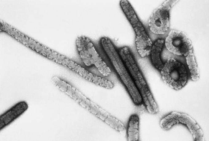 This negative stained transmission electron micrograph (TEM) depicts a number of filamentous Marburg virions.