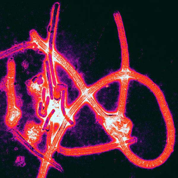 Color-enhanced electron micrograph of Ebola virus particles. (Source: Wikimedia/Thomas W. Geisbert, Boston University School of Medicine)