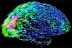 The human brain using colors and shapes to show neurological differences between two people. (Source: Johns Hopkins Medicine/Arthur Toga, UCLA via NIGMS)