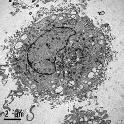 A mast cell. Source: Priyanka Pundir/University of Alberta