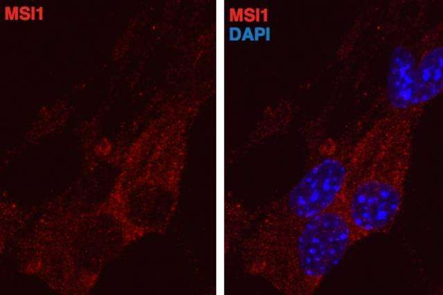 Musashi proteins, stained red, appear in the cell cytoplasm, outside the nucleus. At right, the cell nucleus is stained blue. Source: Yarden Katz/MIT