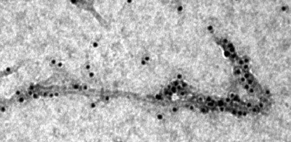 Transmission electron microscopy image showing a molecular chaperone (the black dots) binding to thread-like amyloid-beta (Aβ42). Source: S. Cohen/University of Cambridge