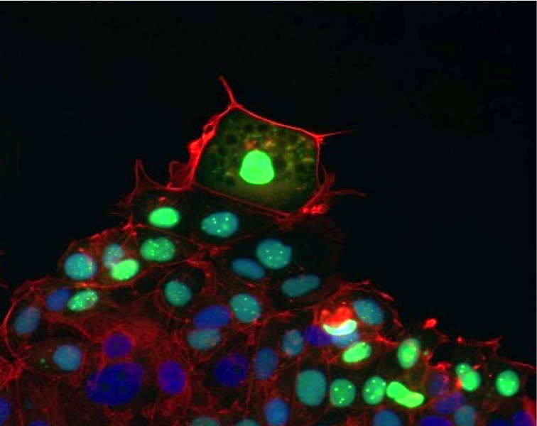 Leader cells, shown fluorescing green in this photomicrograph, pull follower cells in their wake as they move to cover and heal a wound. Source:  Pak Wong/University of Arizona