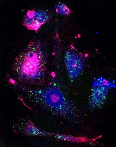 This confocal microscopy image depicts drug-tolerant cancer cells. By hitting breast cancer cells with a targeted therapeutic immediately after chemotherapy, researchers were able to target cancer cells during a transitional stage when they were most vulnerable. Source: Brigham and Women's Hospital/Aaron Goldman