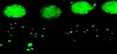 Immunostained mouse auditory nerve synapses after noise exposure. A team led by Keck Medicine of USC neuroscientists first to publish genome-wide association study for noise-induced hearing loss in mice. (Source: Rick A. Friedman Lab/USC)