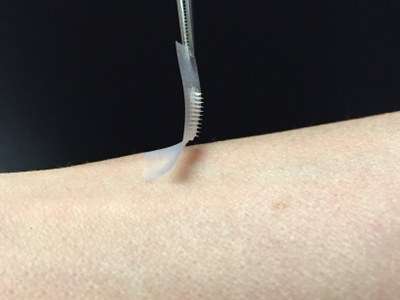 The smart insulin patch could be placed anywhere on the body to detect increases in blood sugar and then secrete doses of insulin when needed. (Image: Courtesy of Zhen Gu, Ph.D.) 