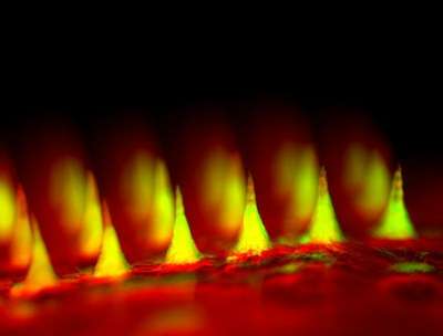 An up-close fluorescent image of the microneedle patch with insulin tagged in green. (Image: Courtesy of Zhen Gu, Ph.D.)