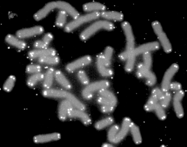 Human chromosomes (grey) capped by telomeres (white) Human chromosomes are kept from unraveling, like nubs on shoelace tips, by telomeres. (Source: Wikimedia)