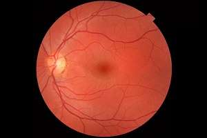 Scientists move closer to curing common eye disorder (Source: University of Manchester)