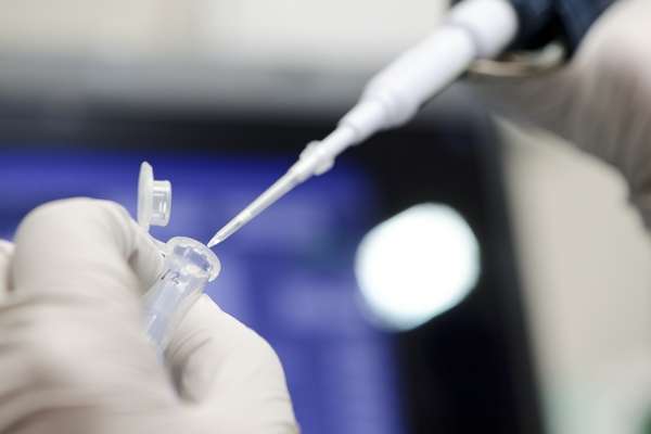 A researcher uses a micropipette to dispense a cell sample and analyze minute amounts of DNA in a science lab at the Influenza Research Institute at the University of Wisconsin-Madison. (Photo: Jeff Miller)