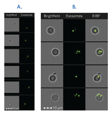 Figure 2. Isolated and cell-bound fluorescently labeled exosomes are detectable by imaging flow cytometry. A. Exosomes labeled with PKH67 were analyzed with the Amnis ImageStream cytometer. Brightfield and FITC-fluorescent images are shown. B. PKH67 prelabeled exosomes were coincubated with peripheral blood mononuclear cells (PBMCs). The degree of internalization of exosomes was measured using the Amnis IDEAS software internalization feature.