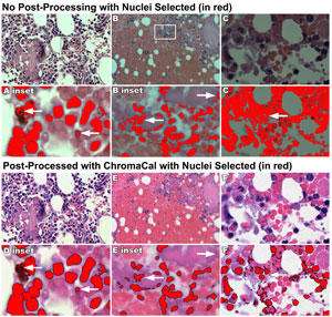 Images A, B and C show inconsistent images taken on a microscope using the Auto setting for exposure and white balancing. Images D, E and F show A, B and C after post-processing using the ChromaCal method to make images consistent. Inset images (A inset, B inset, E inset and F inset) are enlarged areas shown by boxes on A and B. Images below A, B, C and D, E, F show nuclei (in red) after using a color select method for finding bluish nuclei. Image A inset includes selection of non-specific areas, whereas Image D inset does not (see arrows).Image B inset and C show extraneous inclusion of areas, whereas E inset and F do not (see arrows).
