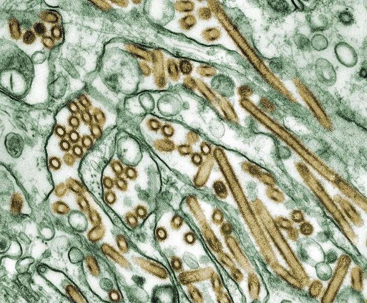 Colorized transmission electron micrograph of Avian influenza A H5N1 viruses (seen in gold) grown in MDCK cells (seen in green).(Source: CDC/Cynthia Goldsmith)