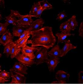 Overlay of nucleus and actin fluorescence after staining on the VANTAGE.