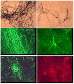 This slide shows (from the top left down) dopaminergic ventral midbrain cells; spinal cord cells; hippocampal cells. The slide to right of each of the first two is an isolation with a particular marker being expressed. The bottom right shows the spinal cord cells are gabaergic. The spinal cord cell above is a motor neuron.