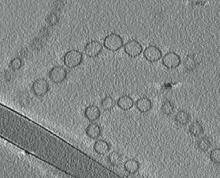 Slice-through cryo-electron tomographic reconstruction of isolated vesicle chains reveals that each vesicle chain is made up of vesicles of a similar size. The scientists found that vesicle size can vary between different vesicle chains, suggesting a tight control of vesicle chain formation. (Credit: Auer Lab)