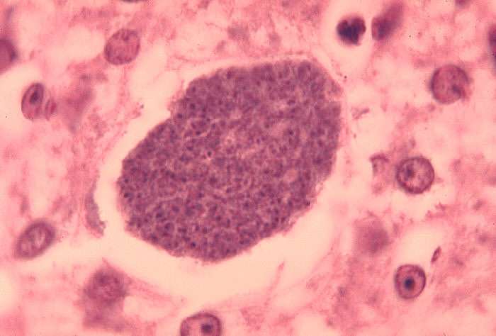 Histopathology of malaria exoerythrocytic forms in liver.