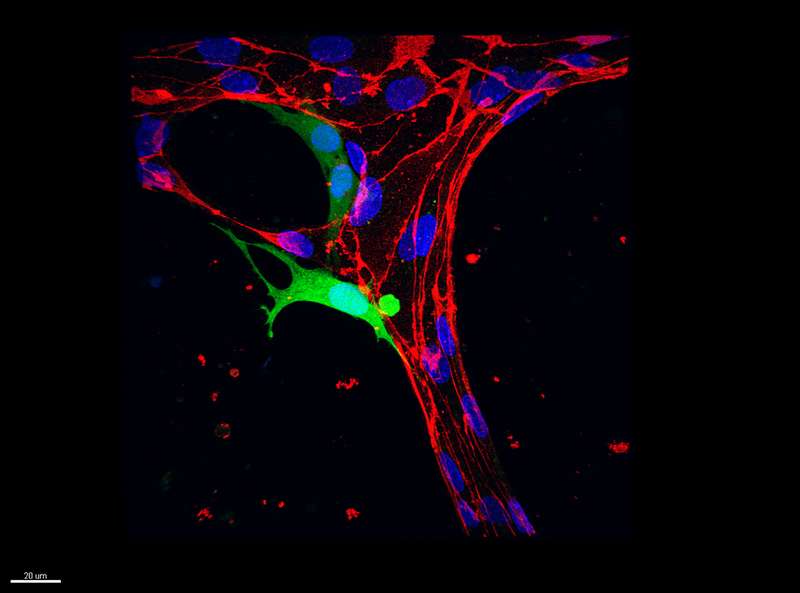 A tumor cell (green) pushes halfway through a blood vessel (red). (Source: MIT/Michelle Chen)