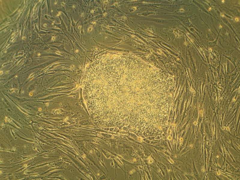 A colony of embryonic stem cells, from the H9 cell line.