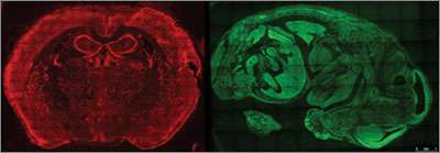 To develop fluorescent in situ sequencing, scientists first fix in place thousands of RNAs—including working copies of genes called messenger RNAs—in cells, tissues, organs or embryos. Here, RNAs are labeled red in a mouse brain (left) and green in a mouse embryo (right). (Source: Wyss Institute and Harvard Medical School)