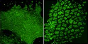 Tooth-precursor cells in the swollen gel (left) are elongated, but as the gel warms and compresses, the cells shrink and round up (right). They also become denser and begin to deposit the minerals that harden teeth. (Source: Basma Hashmi)