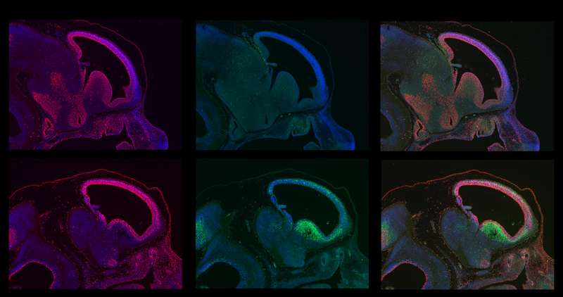 The images show an early developmental stage of normal (top row) and BRCA1-deficient brains (bottom row). The imaged embryos show abundant proliferation of cell growth (red, first column) in both normal and BRCA1-deficient brains at this stage. However brains lacking BRCA1 exhibit high levels of cellular suicide (green, second column). The third column shows an overlay of the other columns. (Source: The Salk Institute for Biological Studies)