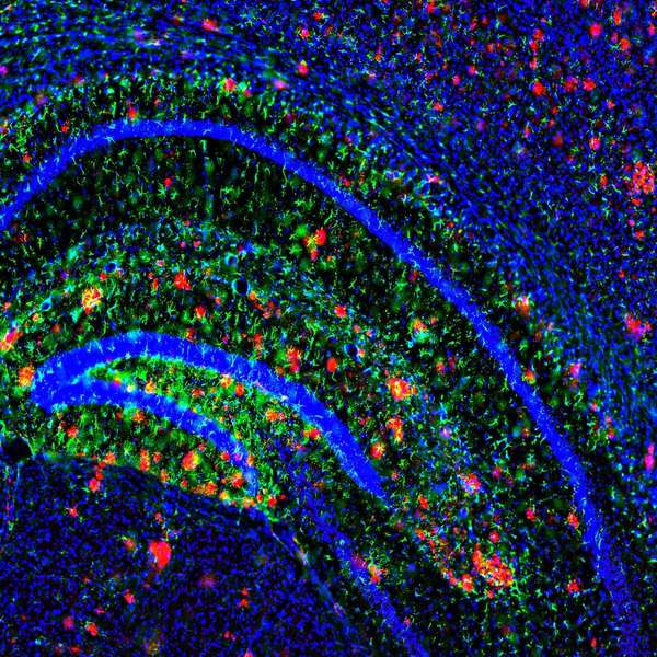 Amyloid plaques (shown in red) dot the brain of a mouse model of Alzheimer's disease. Scientists have found that an antidepressant can reduce production of the primary component in these plaques. (Credit: John Cirrito, PhD)