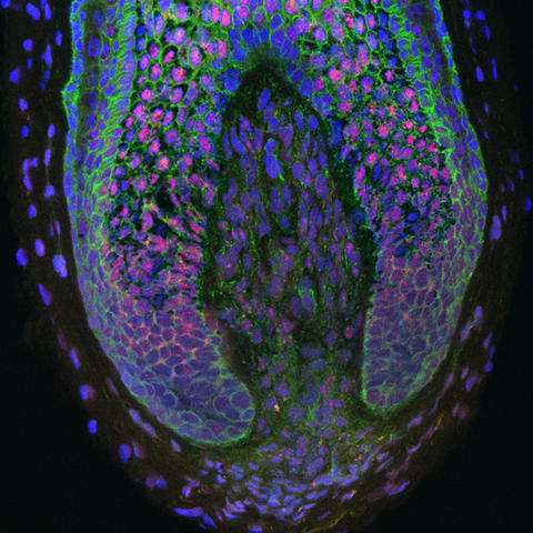 The source of new hair: For the first time, researchers have been able to take human dermal papilla cells (those inside the base of human hair follicles) and use them to create new hairs. (Source: Columbia University Medical Center/Claire Higgins, Christiano Lab)