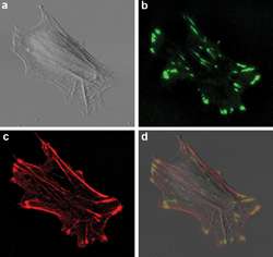 How to Build an Integrated Microscopy System for Live Cell Mechanotransduction Studies